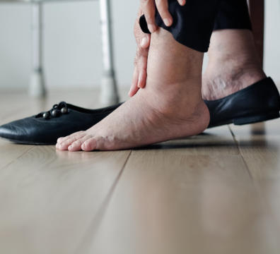 Rétention plutôt que cellulite: Les conseils de Sébastien Barthoulot